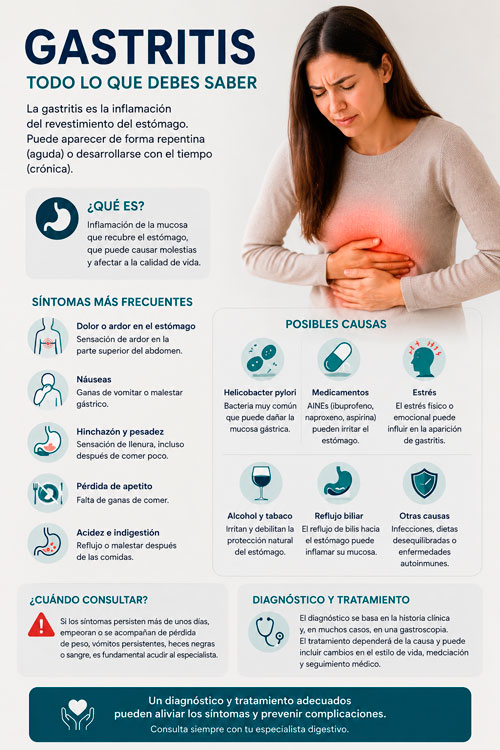Mujer con dolor de estómago junto a una infografía sobre síntomas, causas y tratamiento de la gastritis.